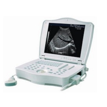 Escáner de ultrasonido Digital de PT3000e1 de equipo médico